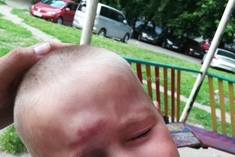 Ребенок разбил голову на прогнившей детской площадке в Барнауле