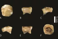 Зуб самого древнего денисовца - девочки 10-12 лет. 