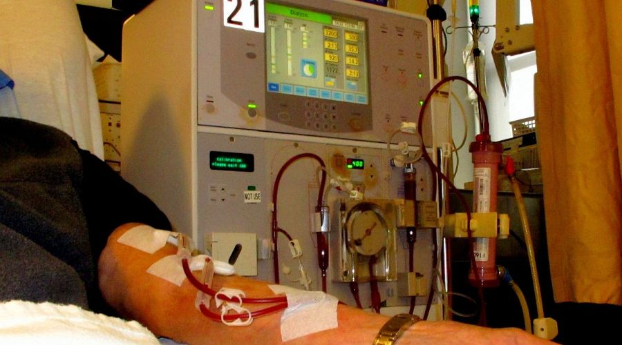 Нуждающиеся в диализе жители алтайских сел обеспокоены новой системой компенсации проезда