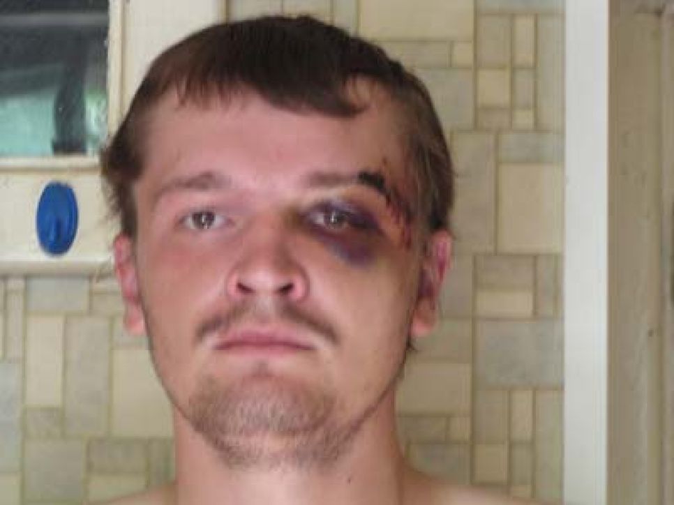 Фотографии молодых барнаульцев после нападения на них
преступников, пытавшихся сорвать их поездку на саммит G8.