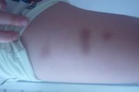 В Барнауле 9-летнего мальчика избили во время лечения в неврологическом отделении