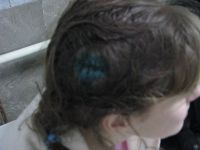 В Барнауле 23-летняя девушка разбила голову, упав в «приямок» у общежития Алтайской педакадемии
