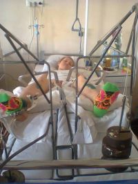 Еще одна жительница Барнаула серьезно пострадала в результате «водного» ДТП