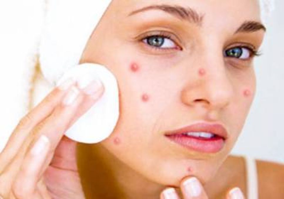 Причины появления и виды прыщей