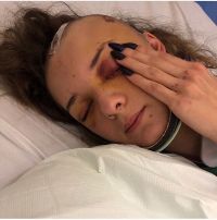 Девушка уже после операции