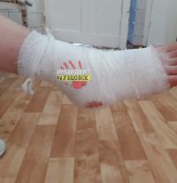 Не стоит недооценивать укус кавказца