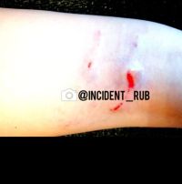 Последствия нападения на улице Революционной