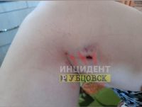 Последствия еще одной атаки якобы той же своры из парка