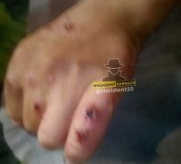 Их тела покрыты гнойниками