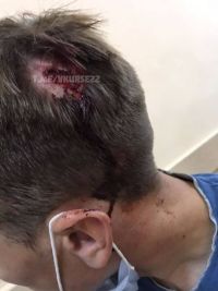 Голова после Che Guevara может болеть не только<span style=