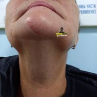 Женщина разбила подбородок