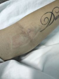 После капельницы