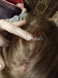 Жительница Барнаула пострадала от «хаотичной» стрельбы в садоводстве