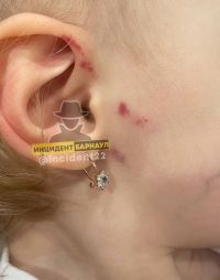 Прокуратура и следком проверяют информацию об истязаниях ребенка в частном детском саду Барнаула