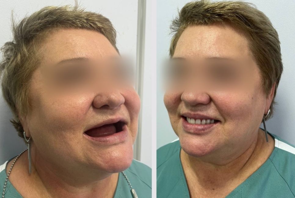 Клиентка White Dental Clinic 