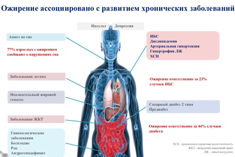 Ожирения и сопутствующие заболевания 