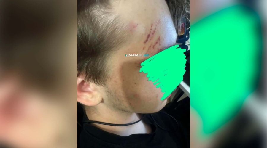 В Барнауле полиция разбирается в нападении подростков на сверстника