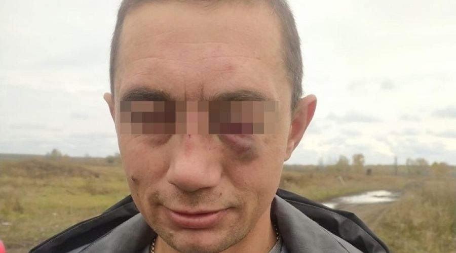 Пострадавший мужчина