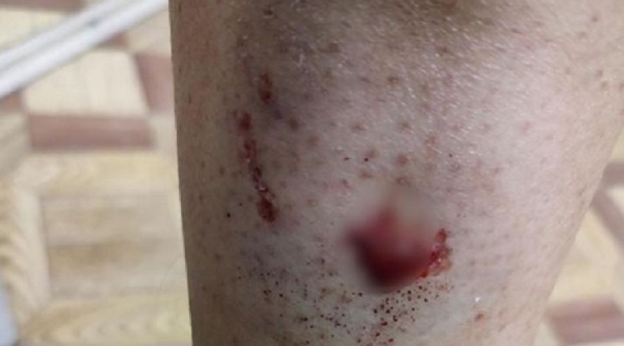 Рана после собаки